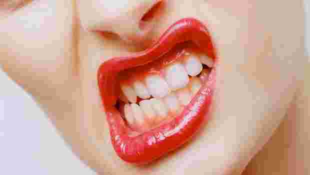 Diş Gıcırdatmanın Nedeni İyi Belirlenmeli!